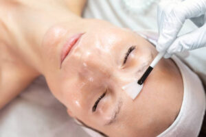 woman getting a chemical peel